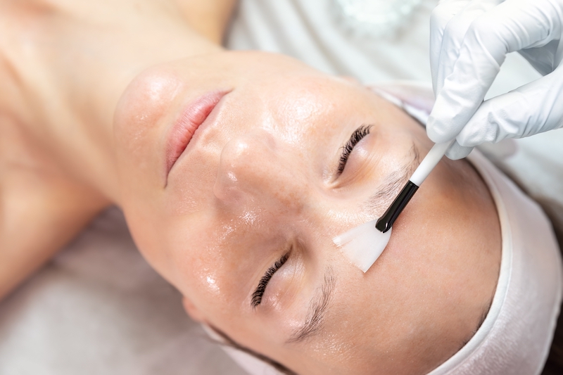 Image of a women receiving a chemical peel / skin peel.